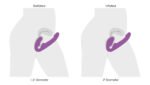 10x Ergo- Fit G-Pulse Inflatable and Vibrating Strapless Strap- on - Purple
