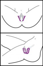 Oral Enhancing Hands Free Labia Spreader - Image 3